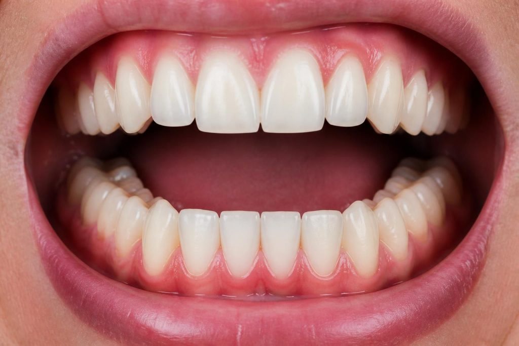 découvrez comment identifier facilement le nom des dents grâce à notre guide clair et illustré. apprenez à reconnaître chaque type de dent rapidement et simplement.